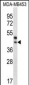 PPT2 Antibody (Center)